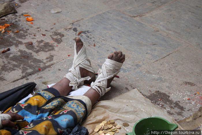Непальские попрошайки отрубают себе пальцы на ногах, чтоб вызвать сочувствие у людей. Такая вот тяжёлая у них работа Непал