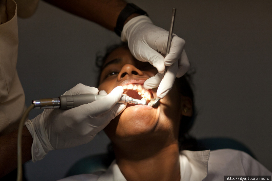Зубной врач один на весь район, он обслуживает около 50 человек в день. Не слодно подсчитать, что на одного пациента он тратит не более 10 минут. Все происходит очень быстро. Врач спрашивает, где болит? Сразу начинает сверлить или выдирать зубы. Южная провинция, Шри-Ланка